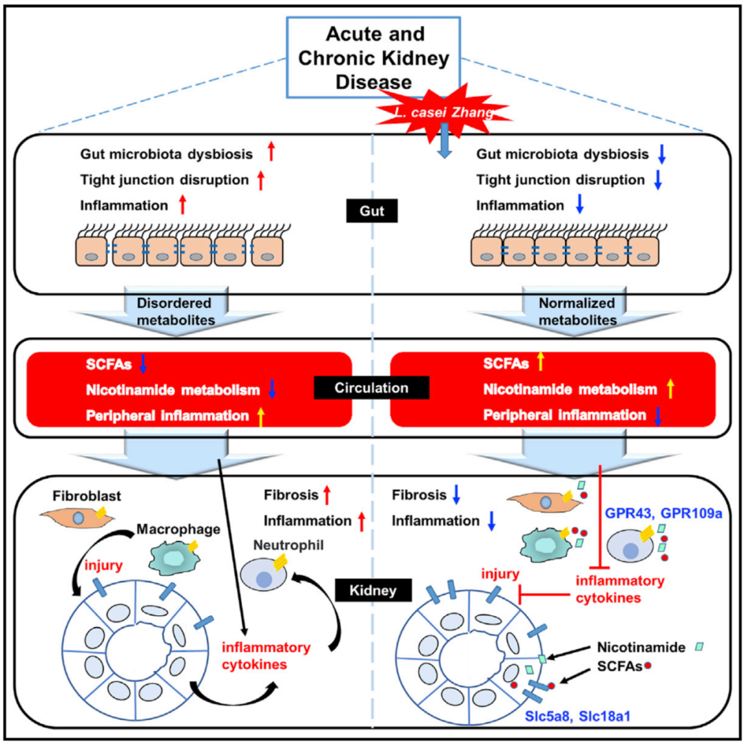 Cell子刊：益生菌可減緩急性和慢性腎臟疾病進展